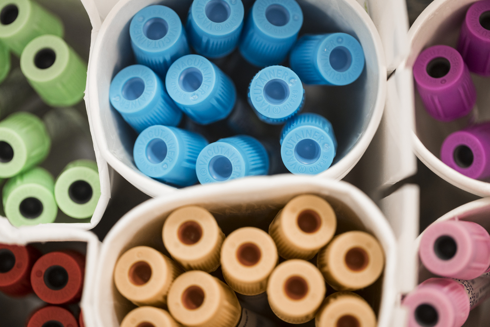 Tubes with colored tops