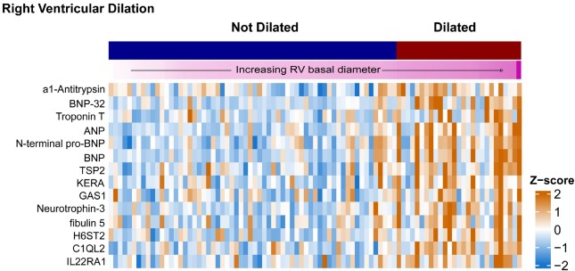 Heatmap showing an increase in 14 metabolites and proteins in PAH patients with RV dilation.